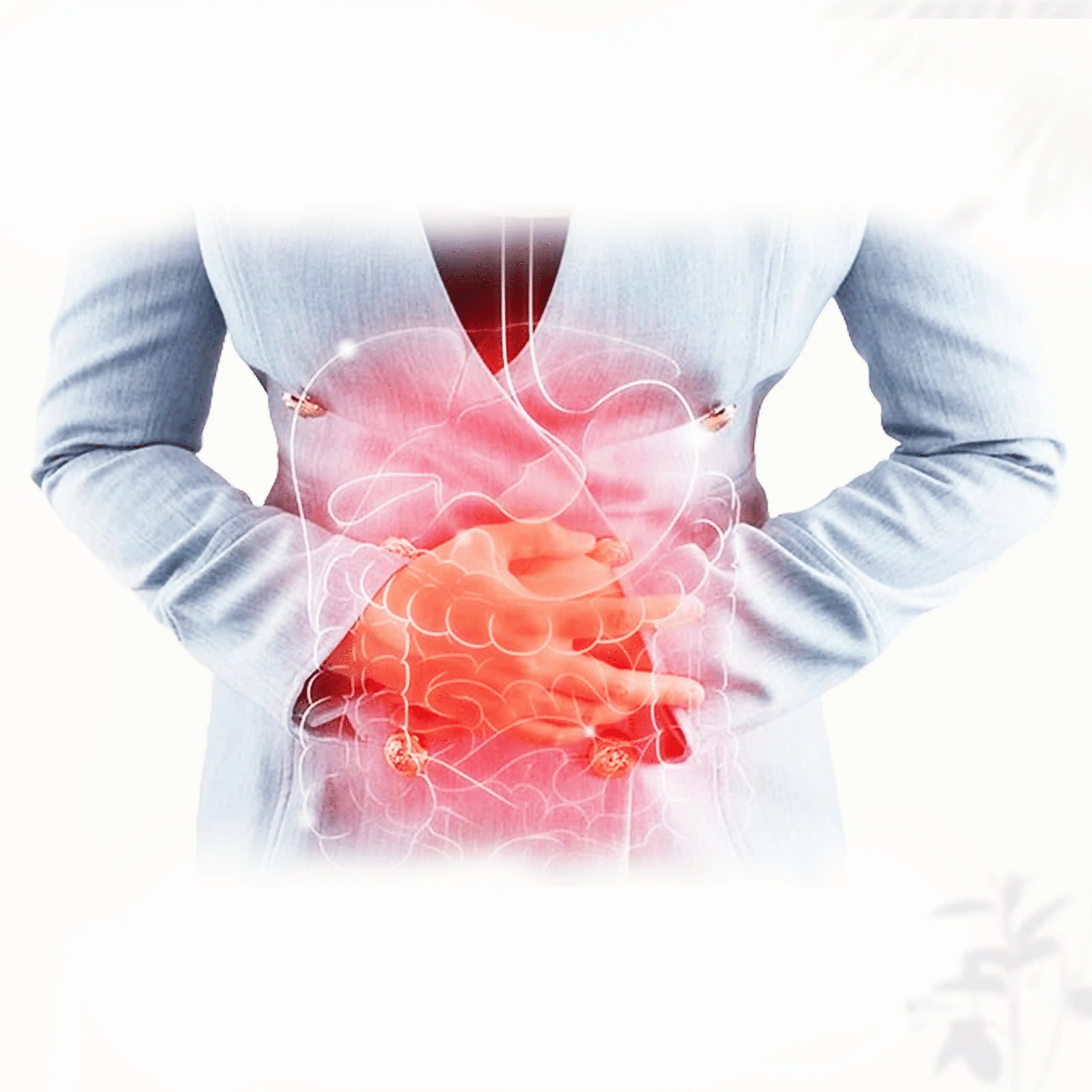 Small Intestinal Bacterial Overgrowth (SIBO) treatment using functional medicine
